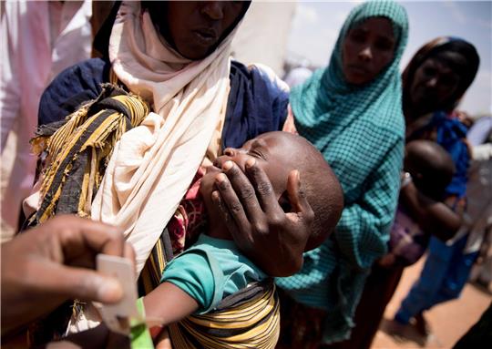 In einer medizinischen Einrichtung in der von Hunger geplagten Region Somali in Äthiopien wird der Armumfang eines Babys gemessen.