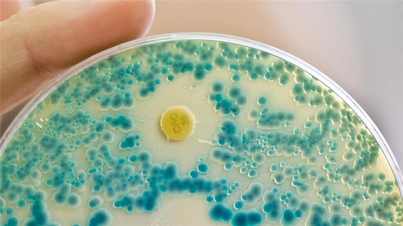 Indikatorkulturplatte zum Nachweis von resistenten Bakterien: Antibiotikaresistente Keime verursachen allein in der EU jährlich Zehntausende Todesfälle. (Symbolbild)