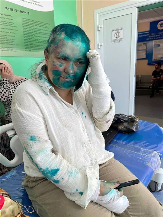 Investigativreporterin Jelena Milaschina wurde nach der Attacke in einem Krankenhaus behandelt.