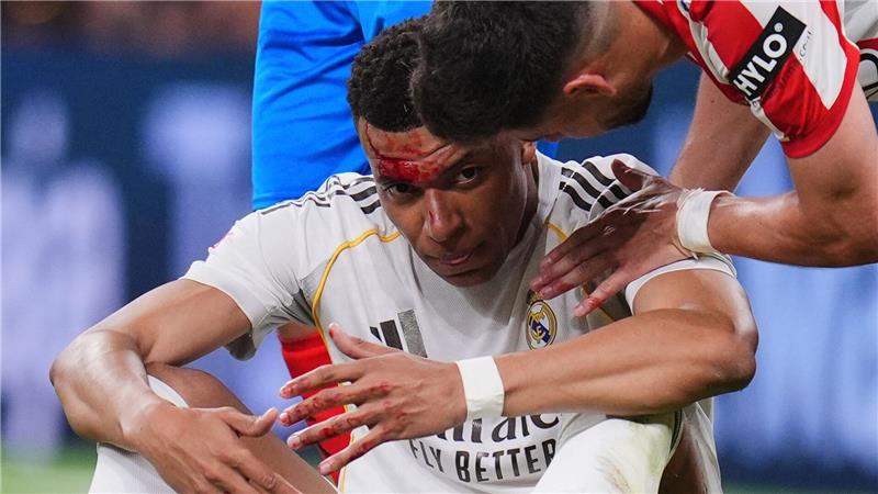 Kopfwunde bei Reals Generalpobe: Aber Kylian Mbappé kann in München wohl auflaufen. (Archivbild)