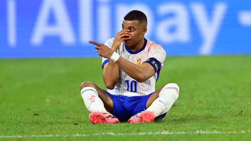 Frankreichs Zittersieg gegen Rangnick - Sorgen um Mbappé Kylian Mbappé musste nach einem Zusammenprall mit einer Nasen-Verletzung ausgewechselt werden.