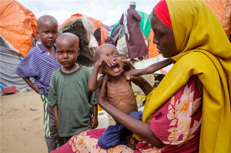 Wie der Klimawandel bereits unsere Gesundheit bedroht Maryan Madey lebt mit ihrer unterernährten Tochter Deka Ali (1) in einem Lager für Vertriebene in Somalias Hauptstadt Mogadischu.