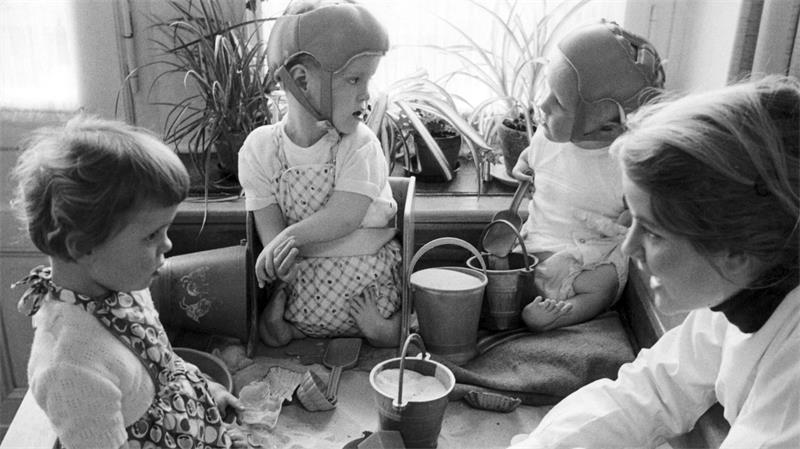 Missbildungen waren die Folge von Contergan-Einnahme während der Schwangerschaft. (Archiv)