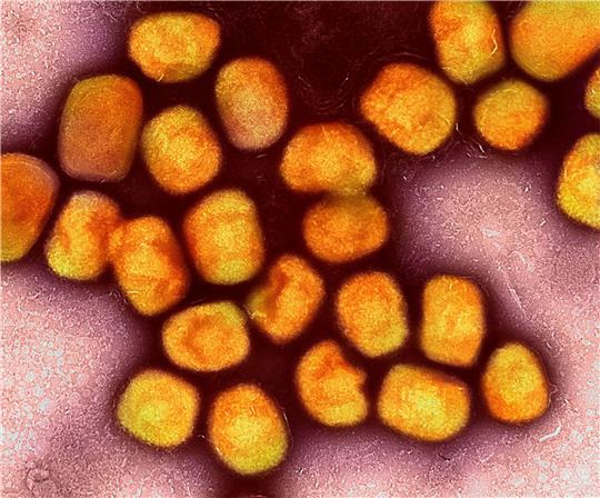 Nach langer Ruhe sind in Deutschland wieder einzelne Infektionen mit dem Virus bestätigt worden.
