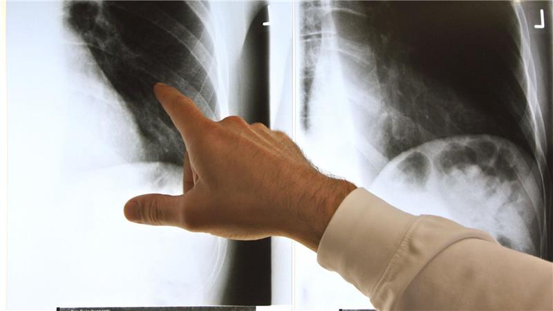 Patientenschützer: Fachärzte müssen Befunde erläutern Patientenschützer sind über die geplanten Neuregelungen bei der Ärztewahl besorgt. (Archivbild)