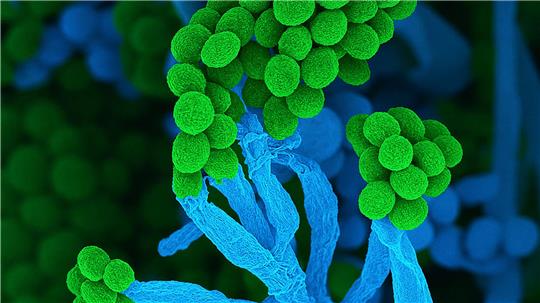 Penicillium bedeutet auf Lateinisch „kleiner Pinsel“, weil die Zellketten mit Sporen am Ende so ähnlich aussehen (Handout)