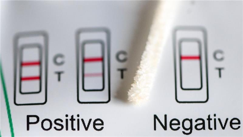 Positiv oder negativ - das zeigt ein Test an. (Symbolbild)