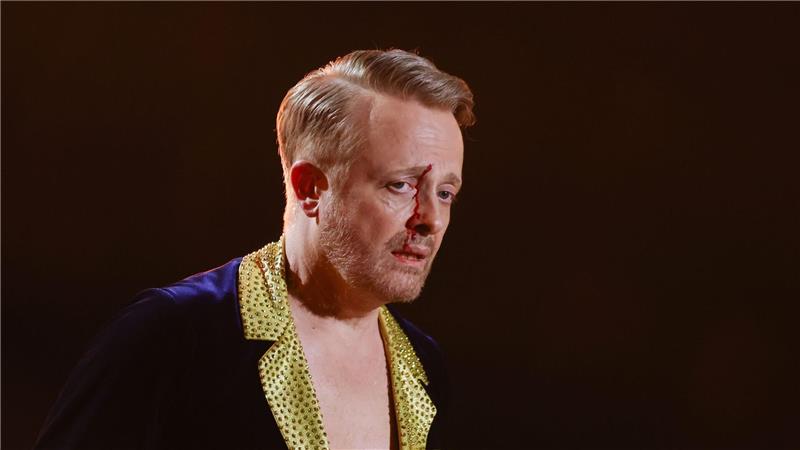 Ross Antony war sichtlich gezeichnet, nahm die Sache aber mit Humor.