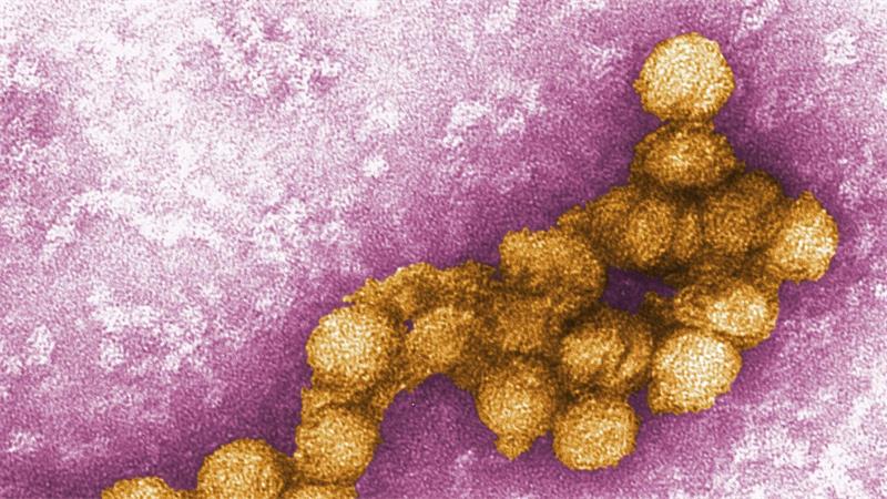 So sieht das West-Nil-Virus unter dem Elektronenmikroskop aus. (Archivbild)