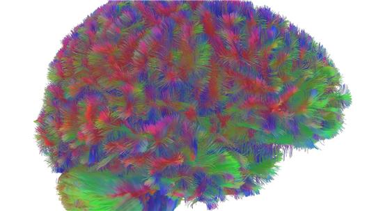 Sogenannte MRT-Diffusionsscans lassen deutliche Unterschiede der Hirnstruktur abhängig vom Alter erkennen.