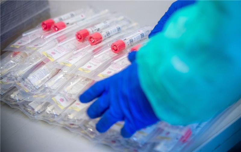 Betrug mit Corona-Teststellen: Auch Kassenärzte prüfen Akten Testsets mit Abstrichstäbchen liegen in einem Testzentrum für Corona-Verdachtsfälle.