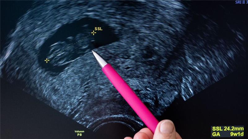 Schwangerschaftsabbruch: Wird Paragraf 218 noch reformiert? Unter bestimmten Umständen werden Abtreibungen innerhalb der ersten zwölf Wochen derzeit nicht bestraft.