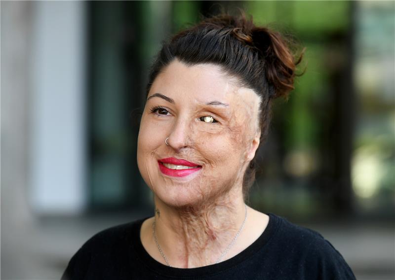 Vanessa Münstermann, Opfer eines Säure-Anschlags, vor dem Landgericht. Foto: dpa