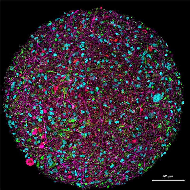 Ein Computerprozessor aus Gehirnzellen Vergrößertes Bild eines im Labor gezüchteten Hirnorganoids mit Fluoreszenzmarkierung für verschiedene Zelltypen.
