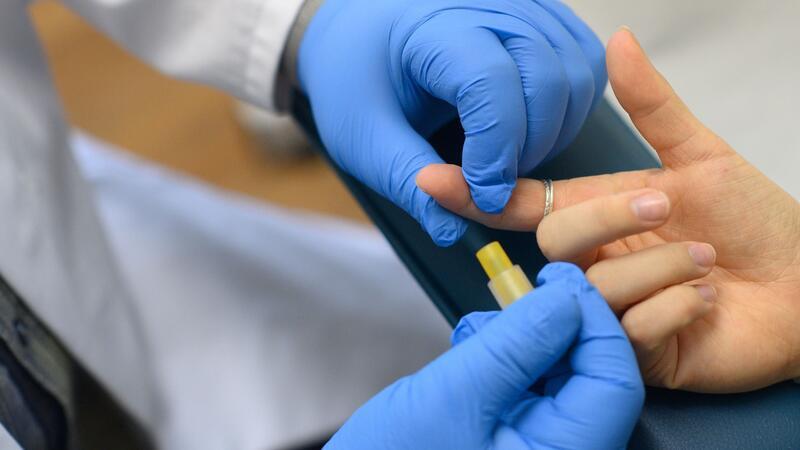 Charité-Forscher: Weiterer Mensch von HIV geheilt Weltweit leben rund 39 Millionen Menschen mit HIV-Infektionen. (Archivbild)