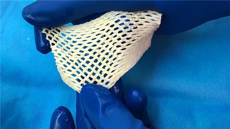 Wichtige Alternative für Hautttansplantationen: Fischhaut.