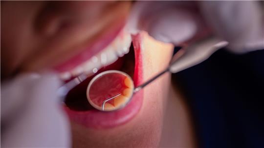 Zahnarztbehandlungen sollen nach dem Willen des CDU-Wirtschaftsrats „nicht länger im Umlageverfahren den Beitragszahlern zur Last fallen“. (Symbolbild)